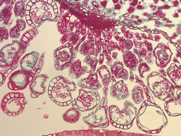 Mature Sporangia Slides - Mature Sporangia 03 100X